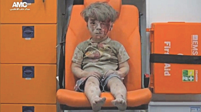 Bloodied face of the injured boy, airstrike in aleppo, syria war, innocent boy