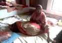 Woman with 60kg leg at Dhaka medical