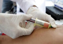 Blood test to detect 8 cancers early gives promising results
