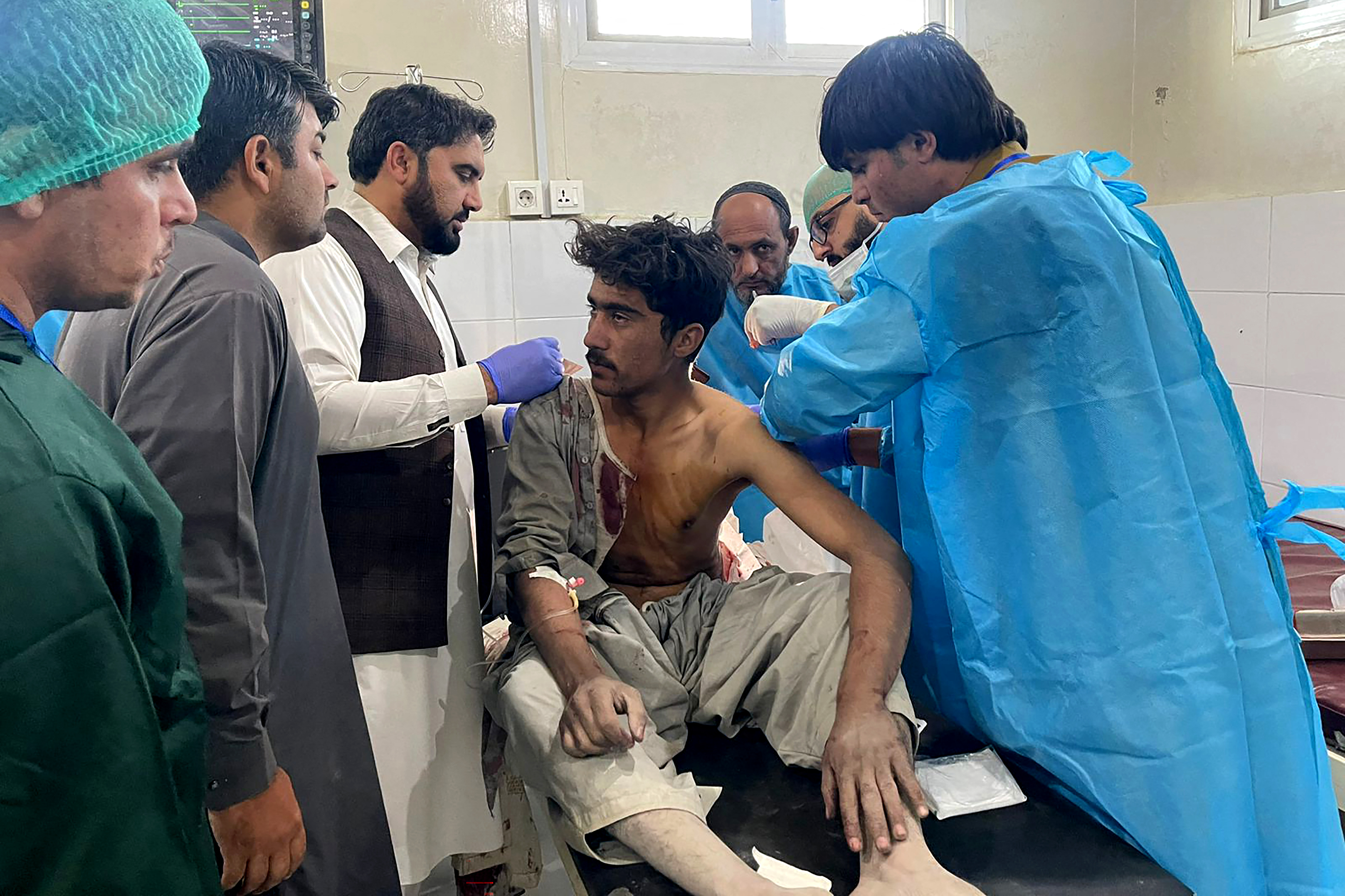 Afghan officials say 15 civilians killed in Pakistan border clashes