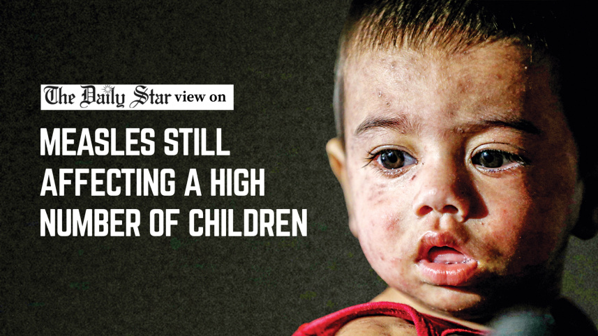 Editorial-2__Measles.jpg