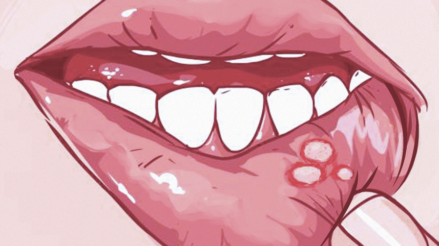 ulcer.jpg