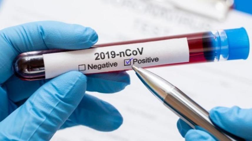 test_coronavirus-positive_0.jpg