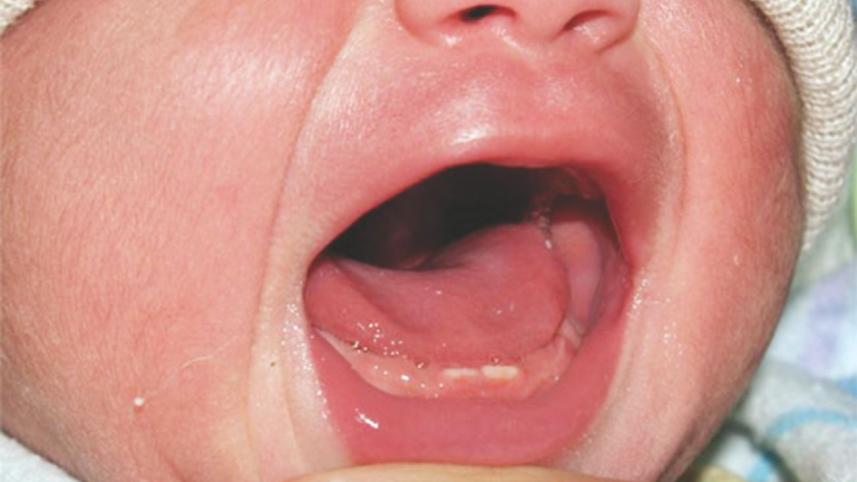 baby teeth.jpg