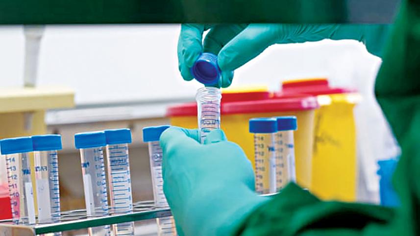 corona-test-samples.jpg