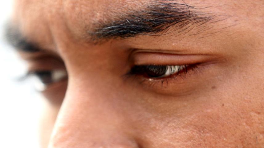 eye
