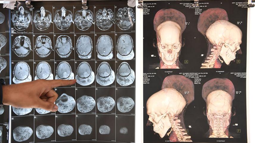 Heaviest tumour