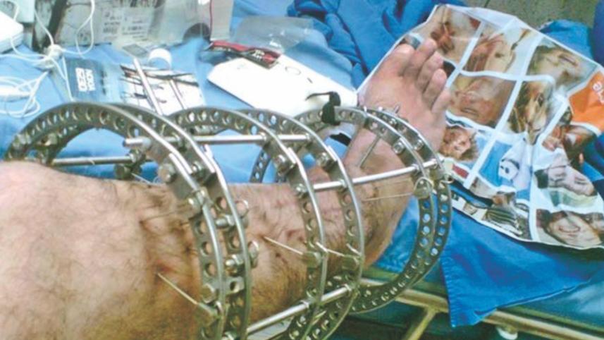 Limb.jpg