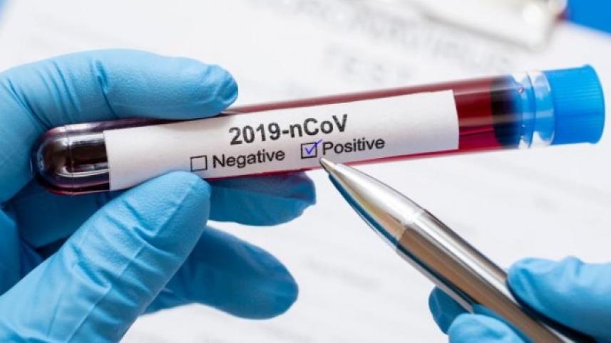 test_coronavirus-positive.jpg