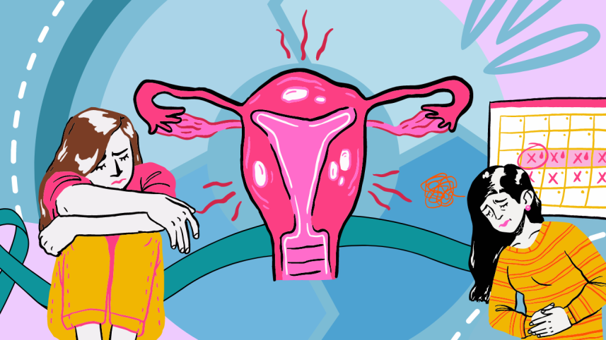 Representative illustration of PCOS