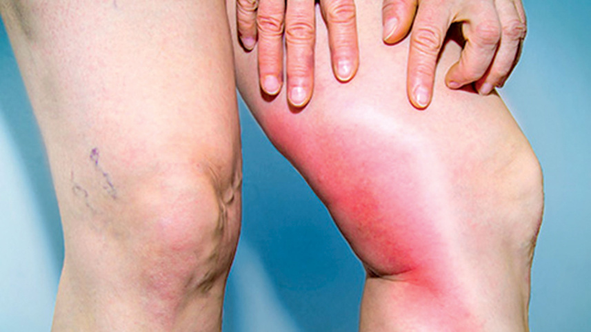 back-pain-3.jpg