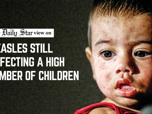 Editorial-2__Measles.jpg