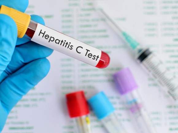 hepatitis_C.jpg