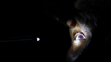 Cataract.jpg