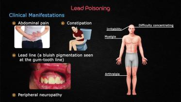 lead-poising.jpg