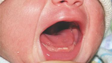baby teeth.jpg