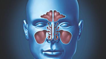 nasal disorders