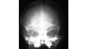 Skull-web.jpg