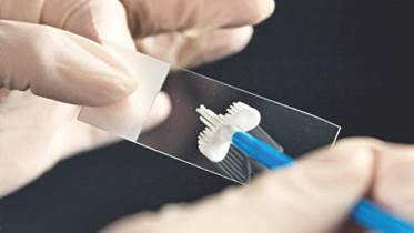 smear test.jpg