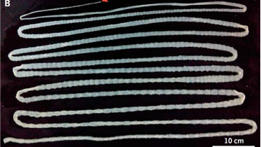 Taenia-saginata-tapeworm.png