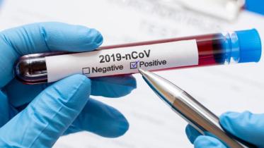 Coronavirus Testing Procedure 