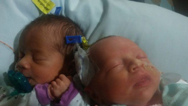 twins-birth.jpg