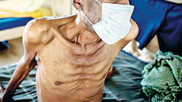 optimising-tuberculosis.jpg