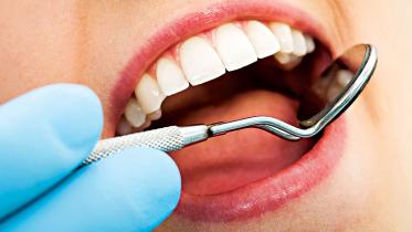 teeth-scaling.jpg