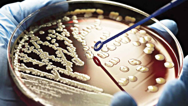 typhoid-causing-bacteria.jpg