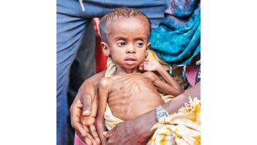 malnutrition.jpg