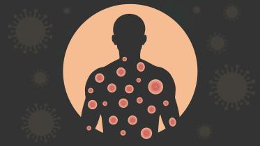 Mpox epidemic in Bangladesh 2024