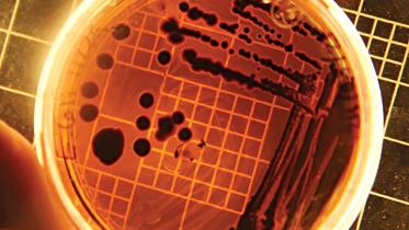 ecoli.jpg