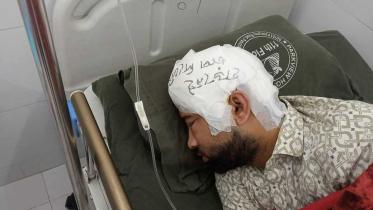 cu_skull_injury.jpg
