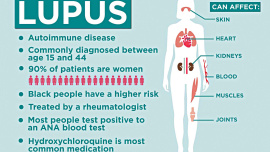 lupus.jpg