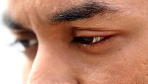 eye