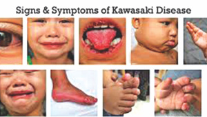 kawasaki.jpg