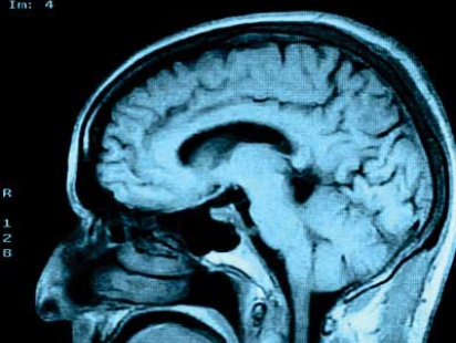 Brain